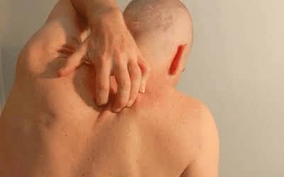 Symptoms Of HIV You Should Never Ignore