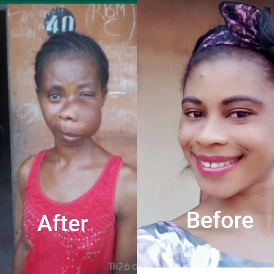 34yr-old Ondo Indigene battling mouth cancer seeks urgent N3m for surgery 