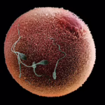 human-sperm (1)